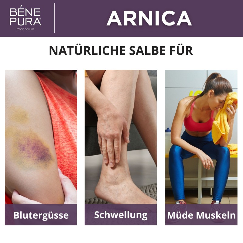 3x Arnika salbe gegen Blaue flecken und Schwellungen - 40ml