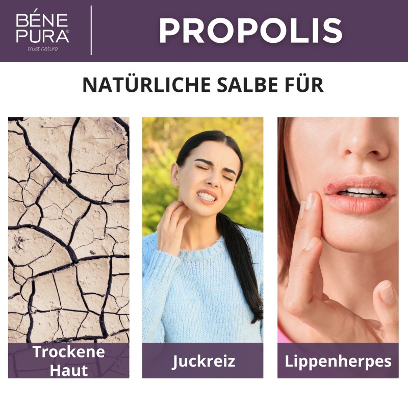 2x Propolis salbe gegen Trockene haut mit 30% Propolis - 40ml