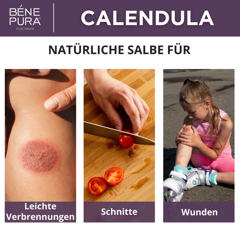 2x Ringelblumensalbe gegen Verbrennungen, Wunden und Narben mit Aloe Vera und Johanniskraut - 40ml