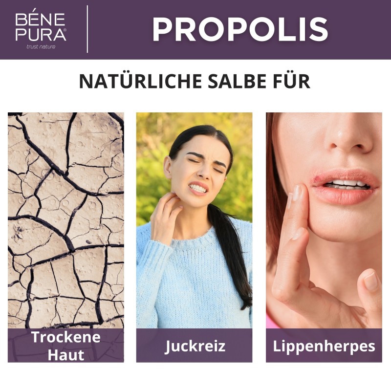 Propolis salbe gegen Trockene haut mit 30% Propolis - 40ml