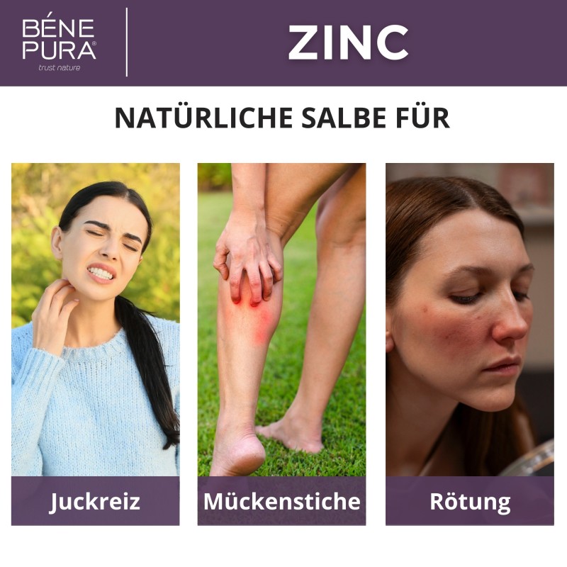 Zinkoxidsalbe gegen Juckreiz und Entzündung - 40ml