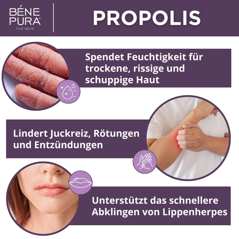 Propolis salbe gegen Trockene haut mit 30% Propolis - 40ml