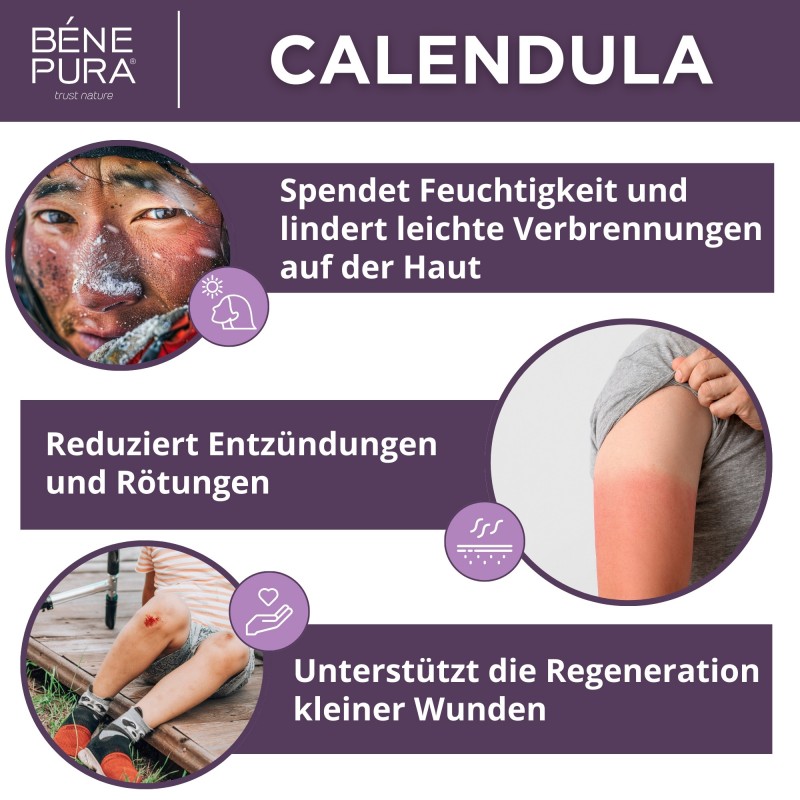 Ringelblumensalbe gegen Verbrennungen, Wunden und Narben - 40ml