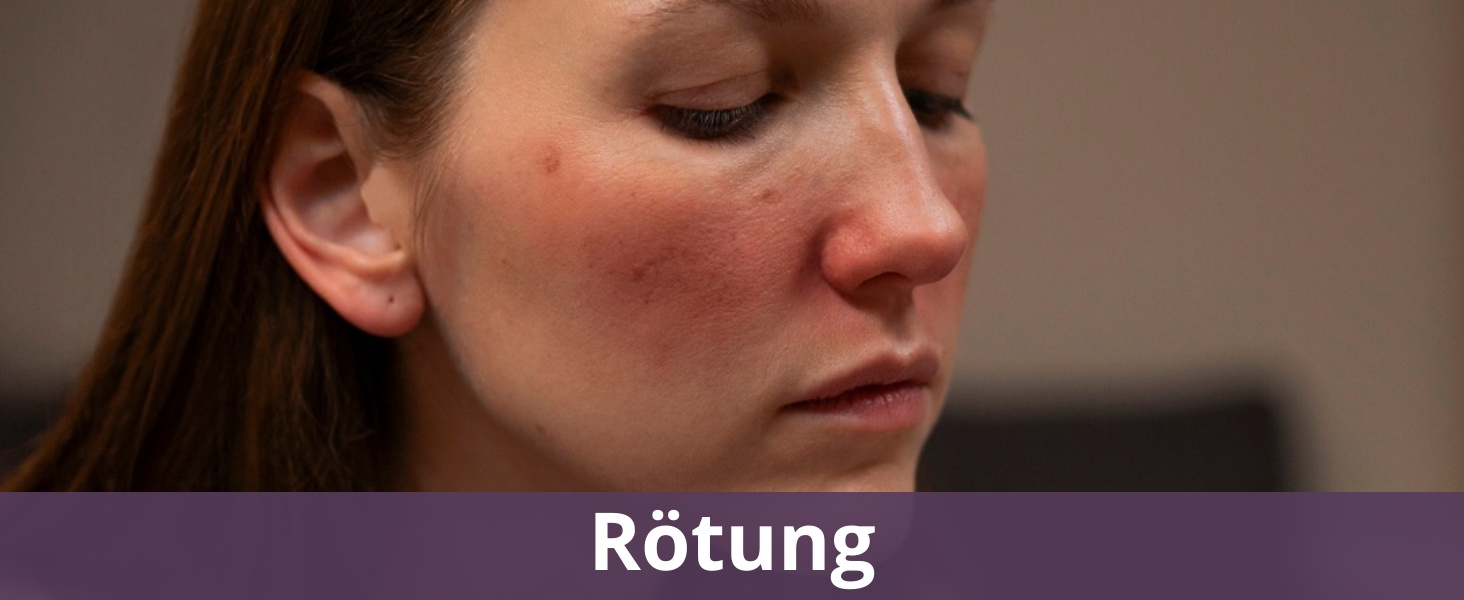 Rötung