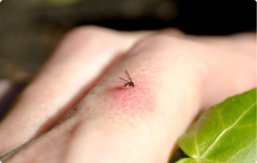 Lindert Insektenstiche